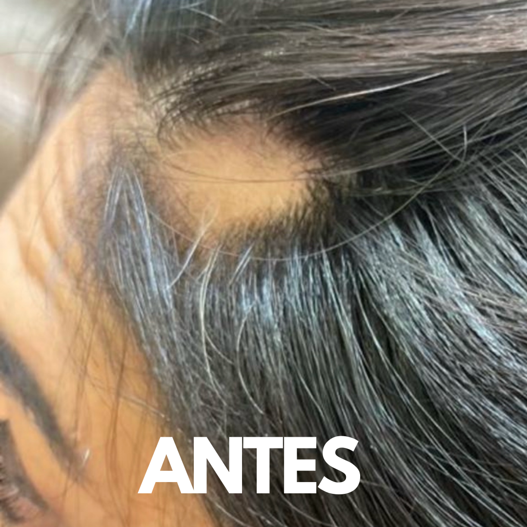 Shampoo de Crecimiento ° Cabello Graso
